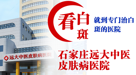 小孩身上有白癜风去石家庄哪家医院好