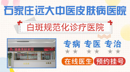 石家庄哪家医院治疗儿童白癜风好