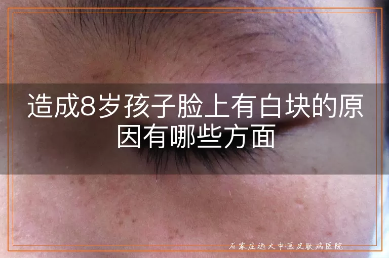 造成8岁孩子脸上有白块的原因有哪些方面