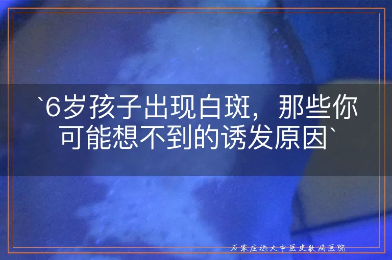 6岁孩子出现白斑，那些你可能想不到的诱发原因