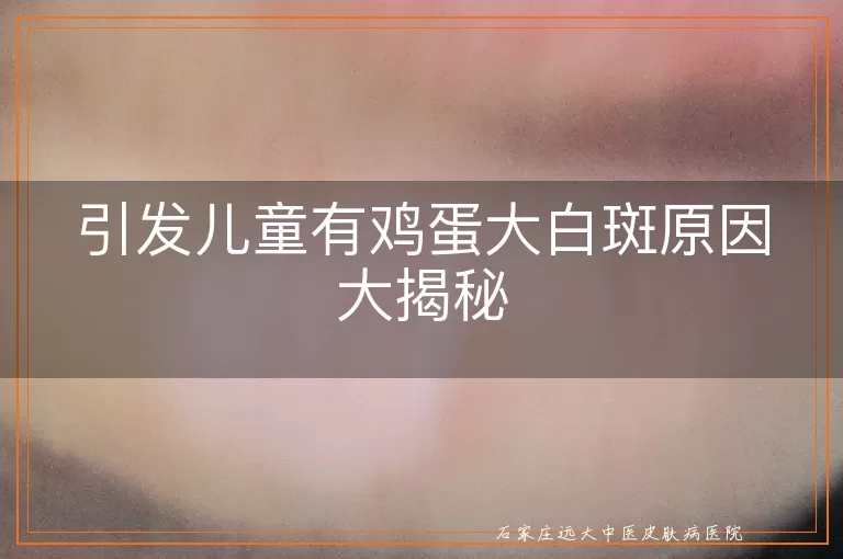 引发儿童有鸡蛋大白斑原因大揭秘