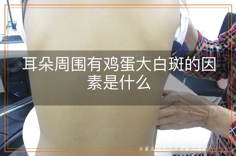 耳朵周围有鸡蛋大白斑的因素是什么
