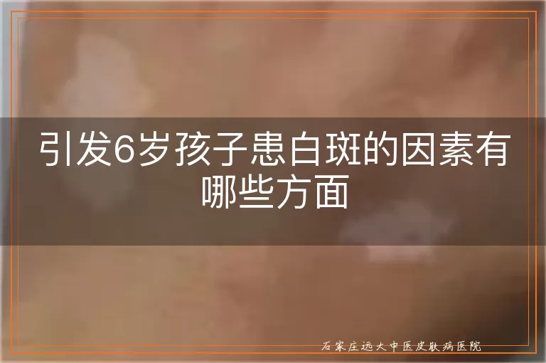 引发6岁孩子患白斑的因素有哪些方面