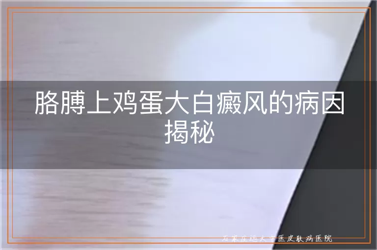 胳膊上鸡蛋大白癜风的病因揭秘