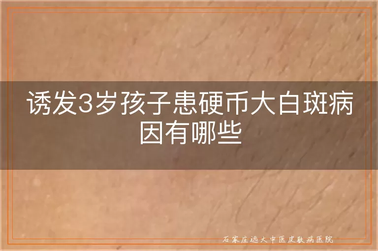 诱发3岁孩子患硬币大白斑病因有哪些