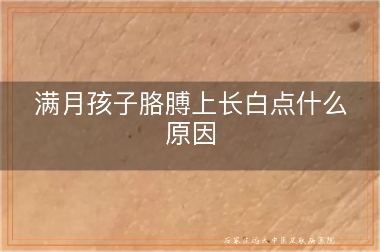满月孩子胳膊上长白点什么原因