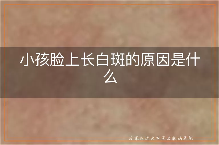 小孩脸上长白斑的原因是什么