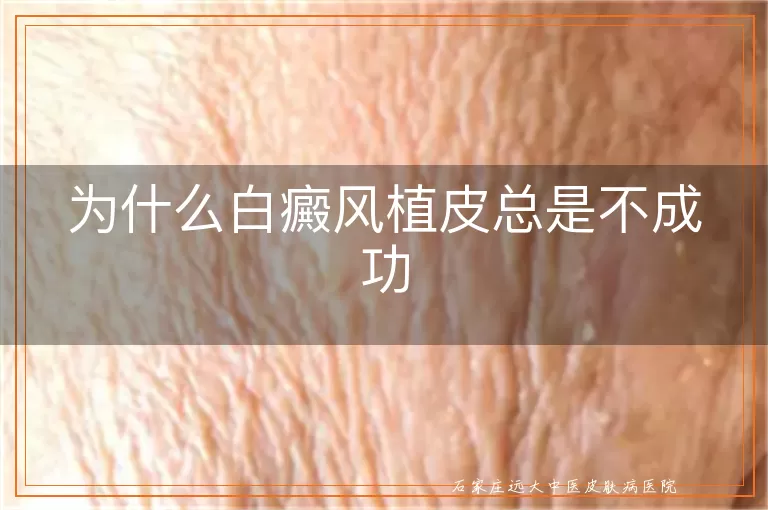 为什么白癜风植皮总是不成功