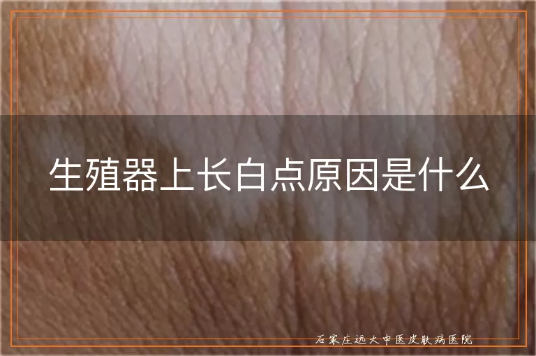 生殖器上长白点原因是什么