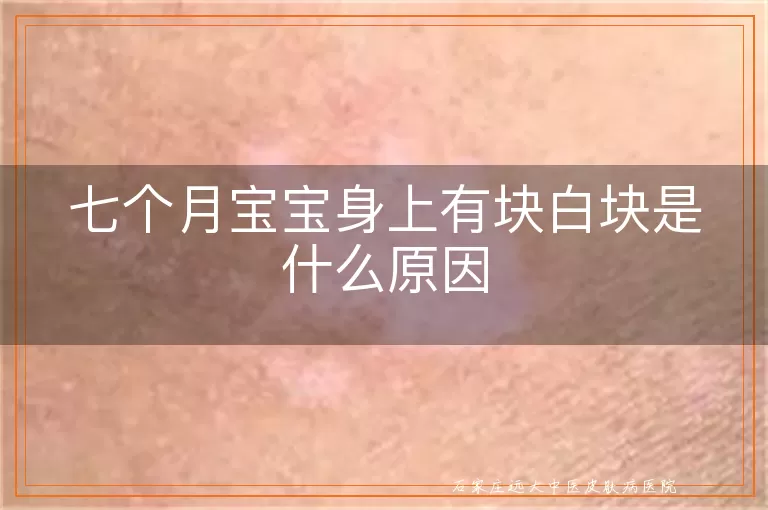 七个月宝宝身上有块白块是什么原因