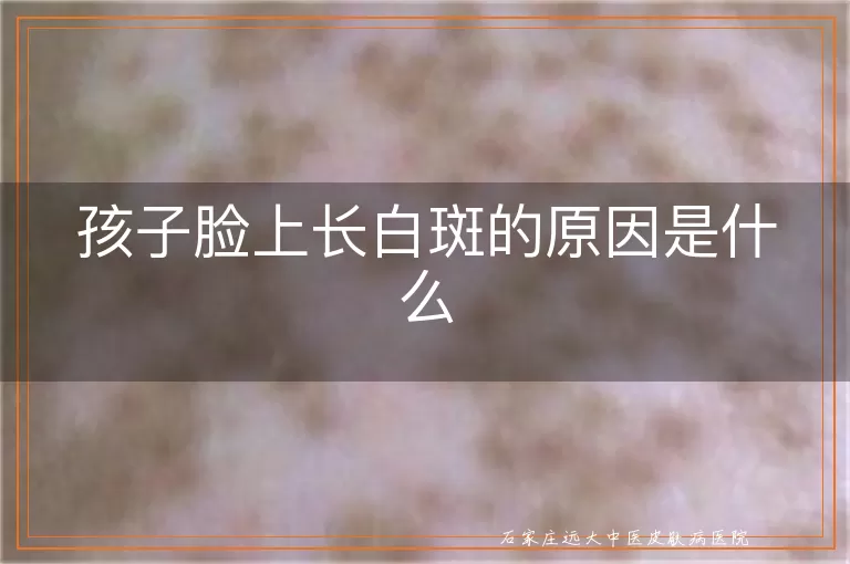 孩子脸上长白斑的原因是什么