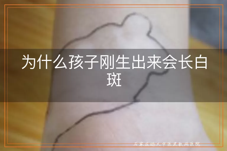 为什么孩子刚生出来会长白斑