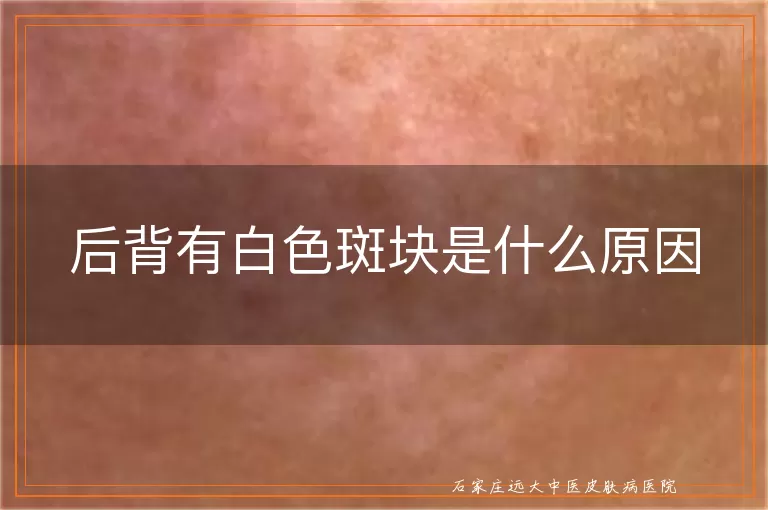 后背有白色斑块是什么原因