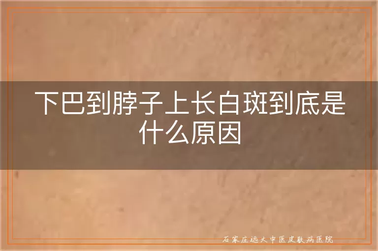 下巴到脖子上长白斑到底是什么原因