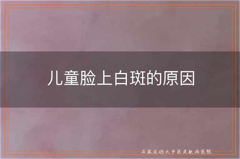 儿童脸上白斑的原因