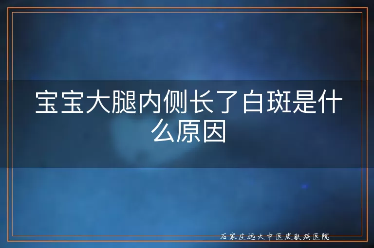 宝宝大腿内侧长了白斑是什么原因