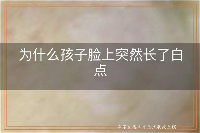 为什么孩子脸上突然长了白点