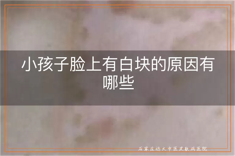 小孩子脸上有白块的原因有哪些