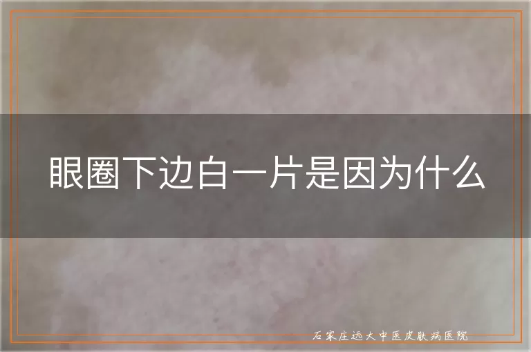 眼圈下边白一片是因为什么
