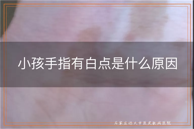 小孩手指有白点是什么原因