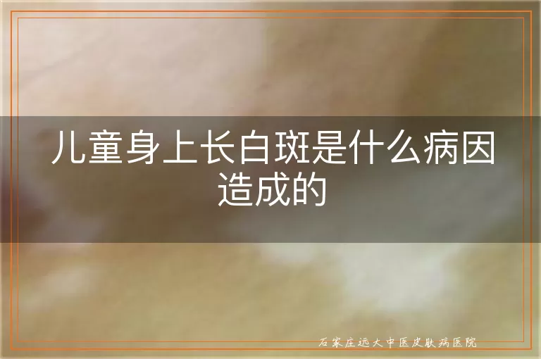 儿童身上长白斑是什么病因造成的