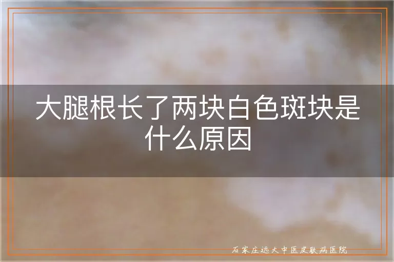 大腿根长了两块白色斑块是什么原因