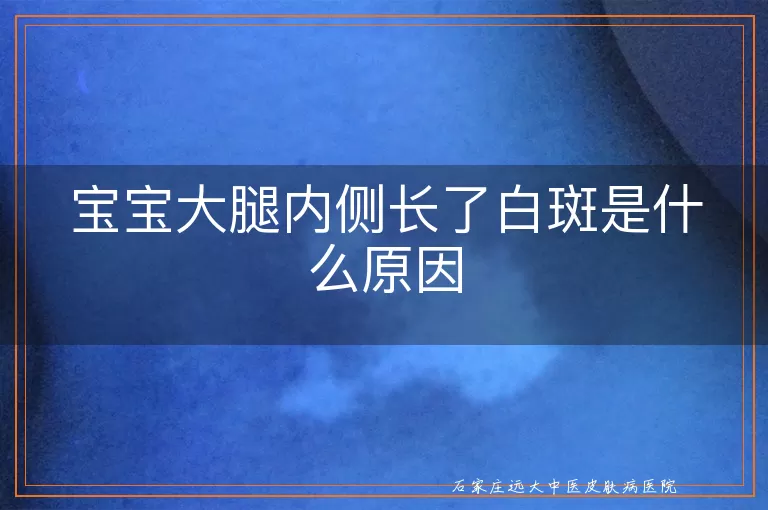 宝宝大腿内侧长了白斑是什么原因