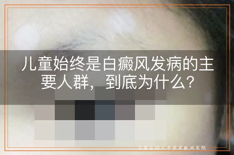 儿童始终是白癜风发病的主要人群，到底为什么?