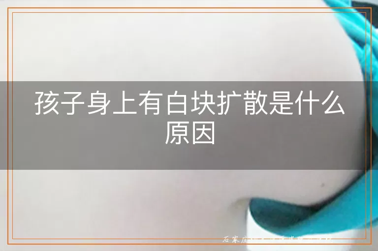 孩子身上有白块扩散是什么原因