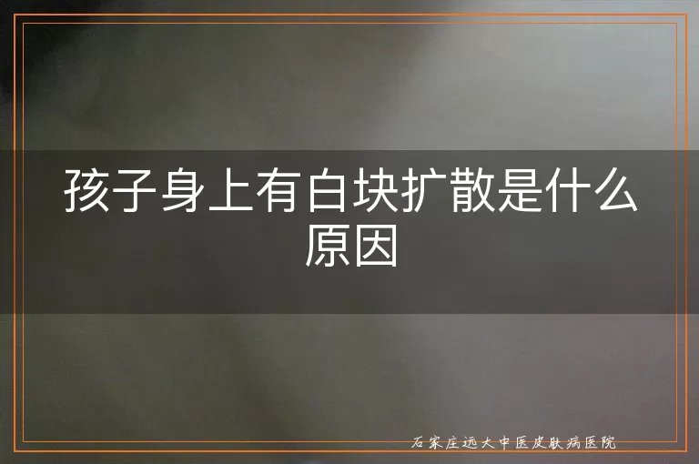 孩子身上有白块扩散是什么原因