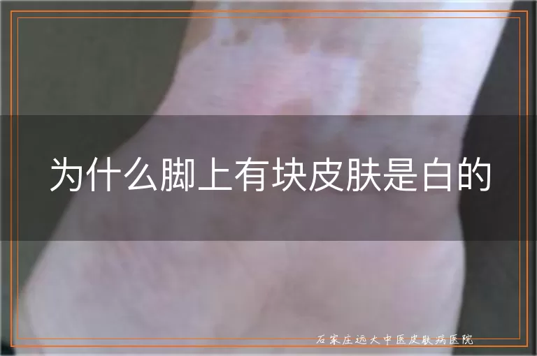 为什么脚上有块皮肤是白的