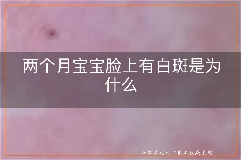 两个月宝宝脸上有白斑是为什么