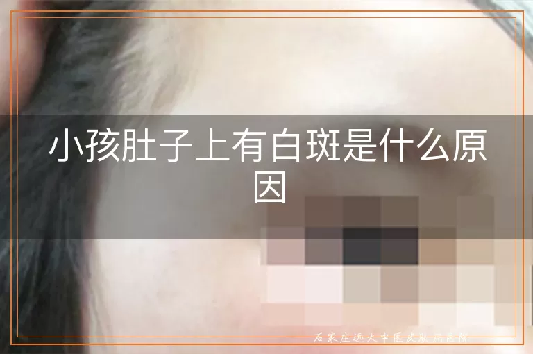 小孩肚子上有白斑是什么原因