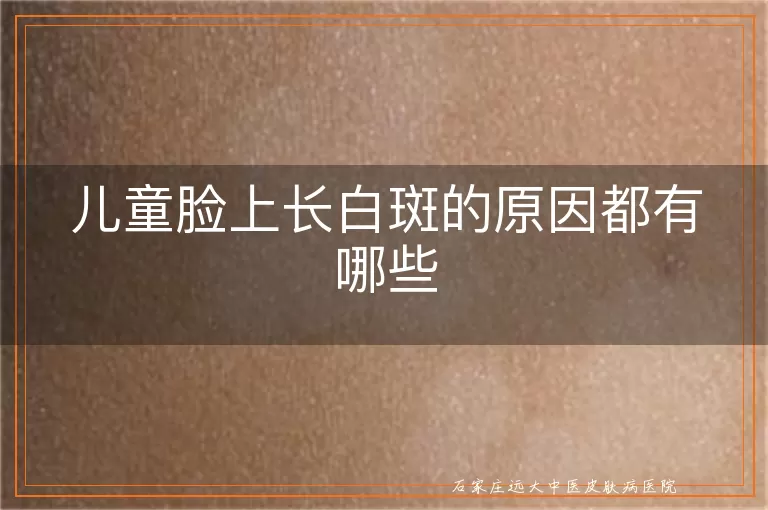 儿童脸上长白斑的原因都有哪些