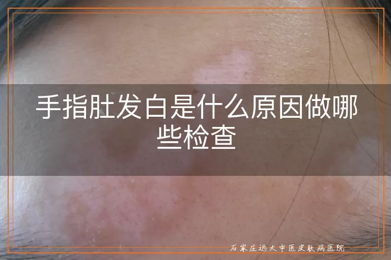 手指肚发白是什么原因做哪些检查