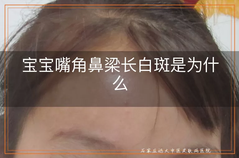 宝宝嘴角鼻梁长白斑是为什么