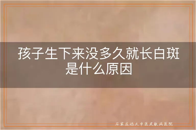 孩子生下来没多久就长白斑是什么原因
