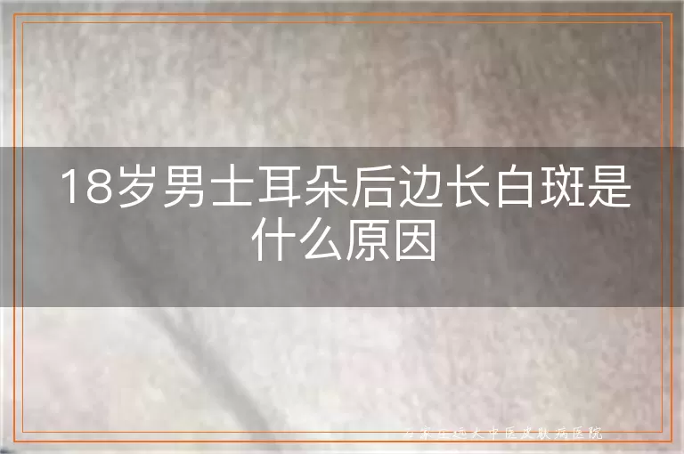 18岁男士耳朵后边长白斑是什么原因