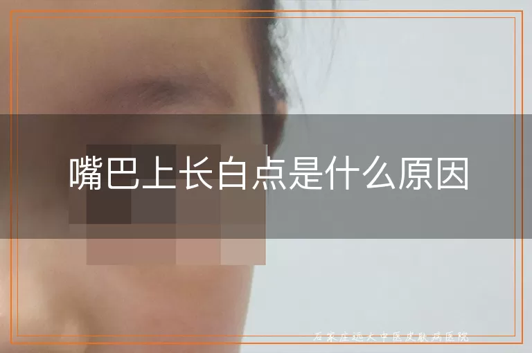 嘴巴上长白点是什么原因