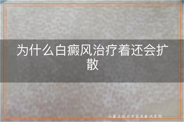 为什么白癜风治疗着还会扩散