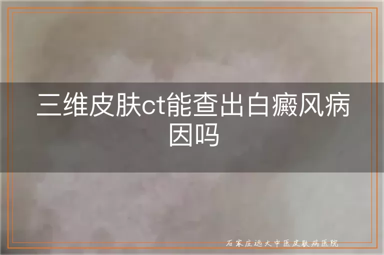 三维皮肤ct能查出白癜风病因吗
