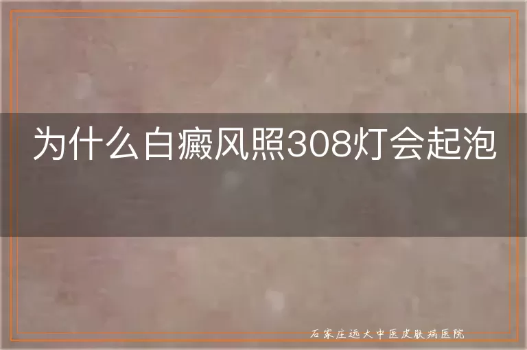 为什么白癜风照308灯会起泡
