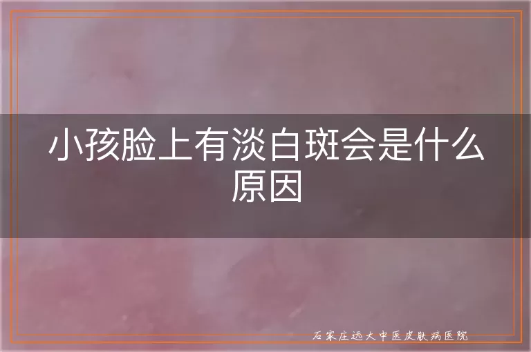 小孩脸上有淡白斑会是什么原因