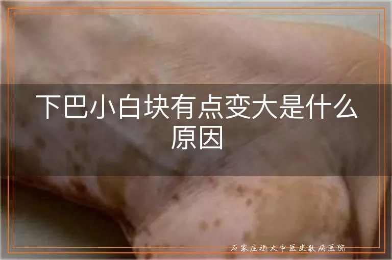 下巴小白块有点变大是什么原因