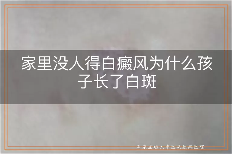 家里没人得白癜风为什么孩子长了白斑