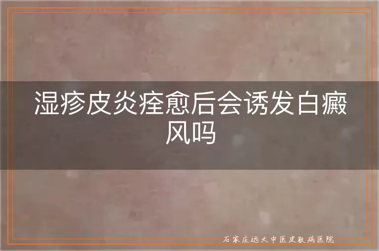 湿疹皮炎痊愈后会诱发白癜风吗