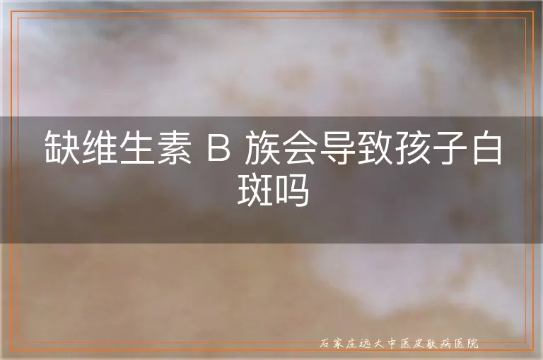 缺维生素 B 族会导致孩子白斑吗