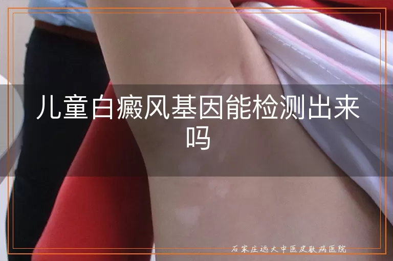 儿童白癜风基因能检测出来吗