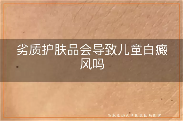 劣质护肤品会导致儿童白癜风吗