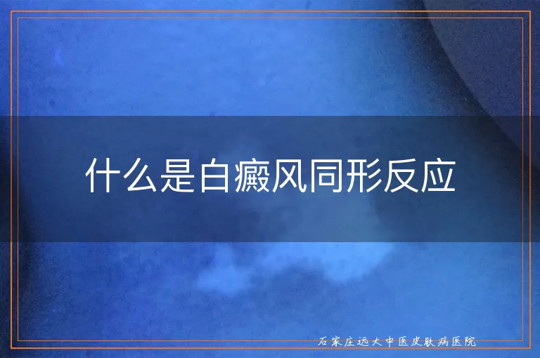 什么是白癜风同形反应